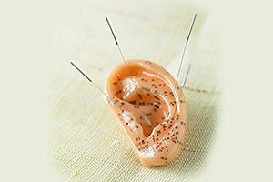 ear acupuncture - Copyright – Stock Photo / Register Mark