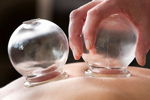 cupping - Copyright – Stock Photo / Register Mark