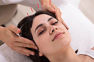 facial acupuncture - Copyright – Stock Photo / Register Mark