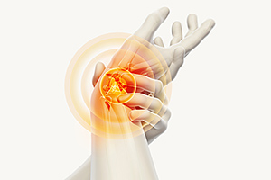 Carpal Tunnel Syndrome - Copyright – Stock Photo / Register Mark