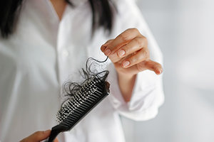 hair loss - Copyright – Stock Photo / Register Mark