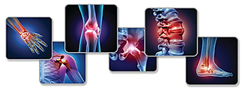 joint pain - Copyright – Stock Photo / Register Mark