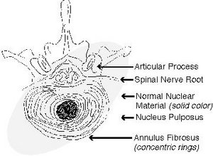 Normal intervertebral disc. - Copyright – Stock Photo / Register Mark