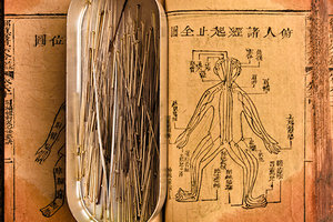 acupuncture points - Copyright – Stock Photo / Register Mark