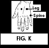 Illustration of Acupuncture points. - Copyright – Stock Photo / Register Mark