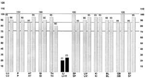 EMI graph of case history #1. - Copyright – Stock Photo / Register Mark