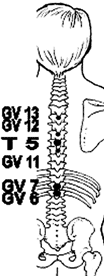 Acupuncture points along the spine for treating chronic pain.
		<div id=