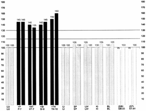 EMI graph of case history #4. - Copyright – Stock Photo / Register Mark