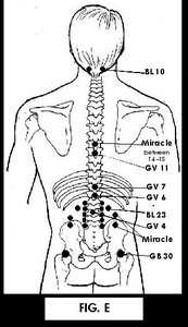 Illustration of Acupuncture points. - Copyright – Stock Photo / Register Mark