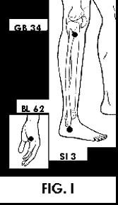 Illustration of Acupuncture points. - Copyright – Stock Photo / Register Mark