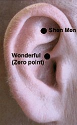 Acupuncture points of the ear for treating chronic pain. - Copyright – Stock Photo / Register Mark