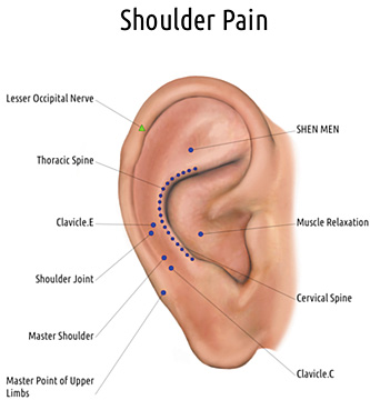 shoulder pain - Copyright – Stock Photo / Register Mark