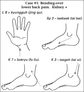 Diagram showing acupuncture points of writst, ankle and foot. - Copyright – Stock Photo / Register Mark