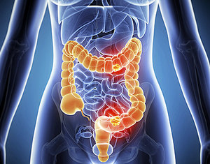 colon health - Copyright – Stock Photo / Register Mark