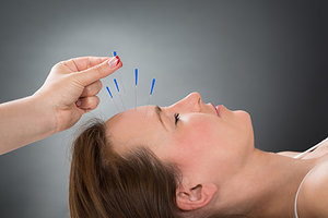 Cosmetic Acupuncture - Copyright – Stock Photo / Register Mark