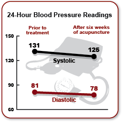 Graph showing how effective Acupuncture is for hypertension. - Copyright – Stock Photo / Register Mark