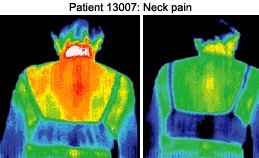 Infrared images of patient. - Copyright – Stock Photo / Register Mark