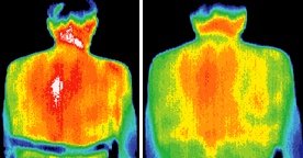 Infrared images of patient. - Copyright – Stock Photo / Register Mark