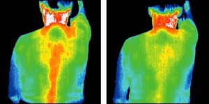 Infrared images of back. - Copyright – Stock Photo / Register Mark