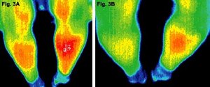 Before and after infrared images of the lower legs of patient. - Copyright – Stock Photo / Register Mark