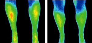 Infrared images of legs. - Copyright – Stock Photo / Register Mark