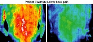 Infrared images of patient. - Copyright – Stock Photo / Register Mark