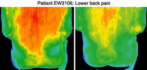 Infrared images of patient. - Copyright – Stock Photo / Register Mark