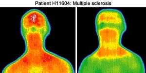 Infrared images of patient. - Copyright – Stock Photo / Register Mark