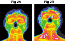 FIG 2A and 2B - Copyright – Stock Photo / Register Mark