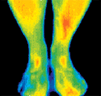 Infared image of lower legs and feet. - Copyright – Stock Photo / Register Mark