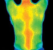 Thermogram of the back of a very healthy woman. - Copyright – Stock Photo / Register Mark