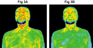 FIG 3A and 3B - Copyright – Stock Photo / Register Mark