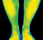 Infared image of lower legs and feet. - Copyright – Stock Photo / Register Mark