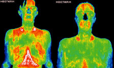 Infrared images showing body surface temperature distribution. - Copyright – Stock Photo / Register Mark