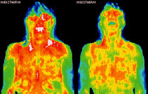 Infrared images showing body surface temperature distribution. - Copyright – Stock Photo / Register Mark