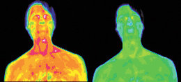 Infrared images of the face and shoulder of a male with genital herpes. - Copyright – Stock Photo / Register Mark