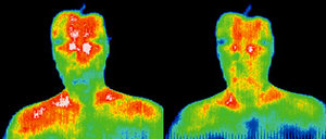 Infrared images showing body surface temperature distribution. - Copyright – Stock Photo / Register Mark