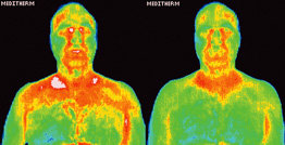 Infrared images showing body surface temperature distribution. - Copyright – Stock Photo / Register Mark