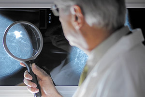 mammography - Copyright – Stock Photo / Register Mark