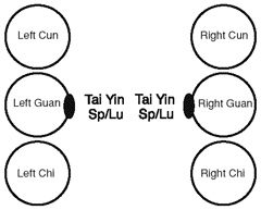 Tai yin channel involvement in a 73-year-old patient. - Copyright – Stock Photo / Register Mark