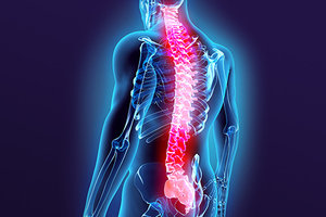 Acupuncture and the Treatment of Spinal Stenosis - Copyright – Stock Photo / Register Mark