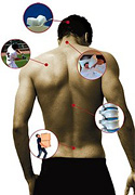 An athletic man's back with visual representaions of the sources of his pain. - Copyright – Stock Photo / Register Mark
