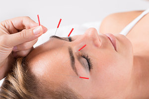 The Science Behind the Efficacy of Cosmetic Acupuncture - Copyright – Stock Photo / Register Mark