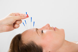 The FDA Recommends Acupuncture: Comments From Key AOM Stakeholders - Copyright – Stock Photo / Register Mark