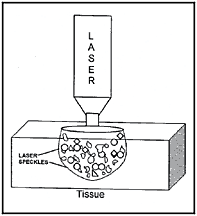 Illustration showing laser penatrating tissue. - Copyright – Stock Photo / Register Mark