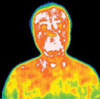 Infrared picture of a patient before acupuncture treatment. - Copyright – Stock Photo / Register Mark